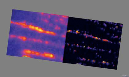 MICROSCOPIC IMAGING OF PROTEINS CALLED SEPTINS IN CELLS