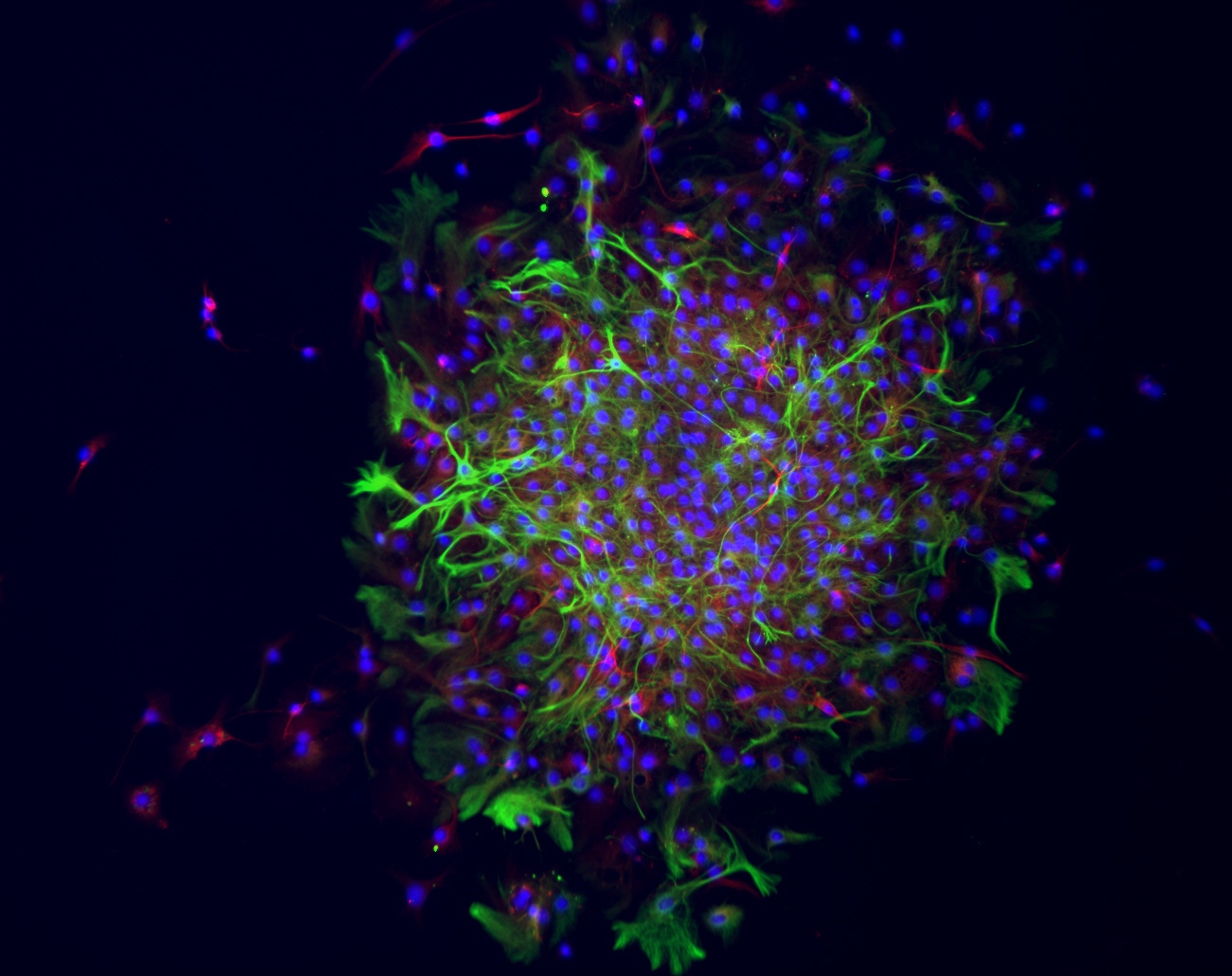 STEM CELLS FROM ADULT BRAIN CAN TURN INTO NEURONS (RED) AND GLIAL CELLS (GREEN), WHICH HELP IN BRAIN REPAIR