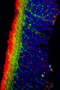 RETINAL STEM CELLS (GREEN) TRANSPLANTED INTO THE MOUSE EYE