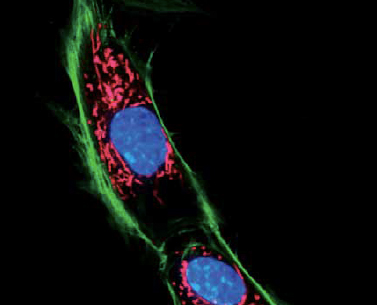A HUMAN FIBROBLAST WITH NUCLEAR (BLUE), MITOCHONDIAL (RED) AND PLASMA MEMBRANE (GREEN) STAINING