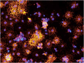 picture of DIFFERENTIATED NEURAL STEM CELLS