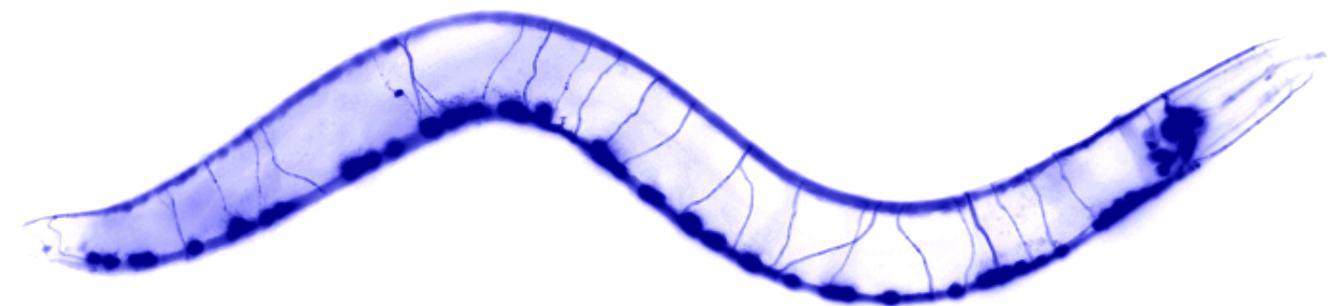 A NEMATODE WORM ILLUMINATED WITH FLUORESCENT MARKERS