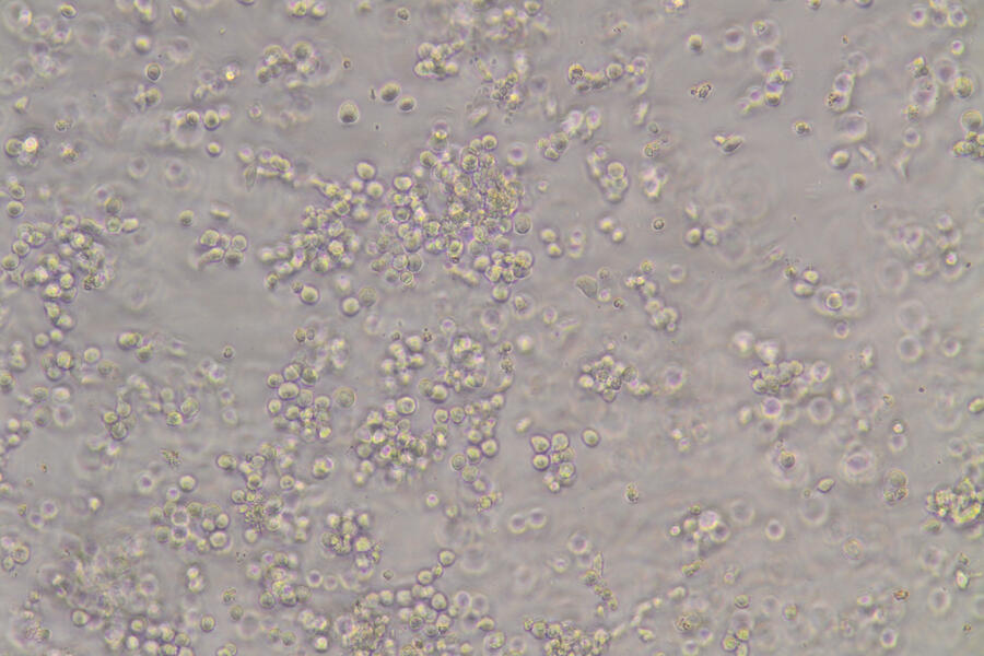 stem cells in a dish