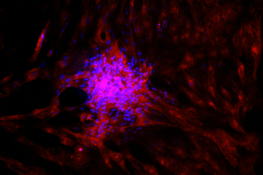 stem cells turning into photoreceptors in a dish