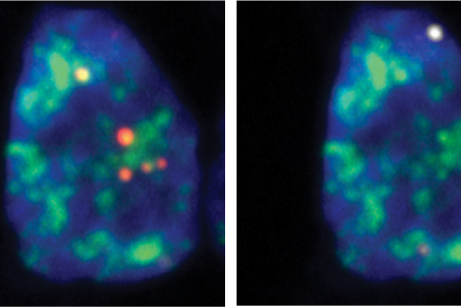 Microscopy images of cell nuclei with fluorescently labeled RNA transcripts 