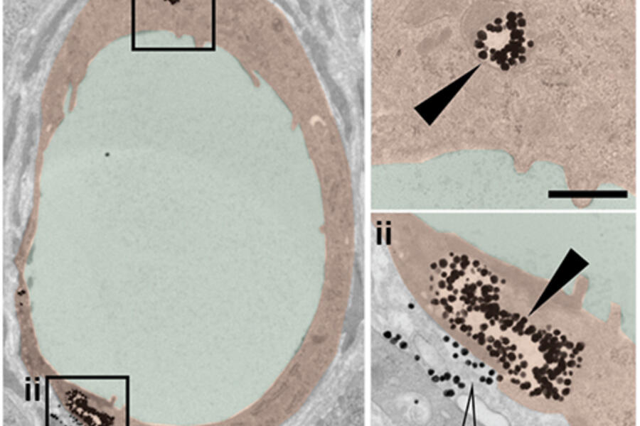 Nanoparticles