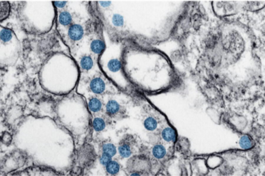 coronavirus particles