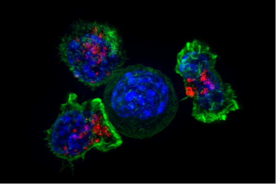 a cancer cell surrounded by immune T cells