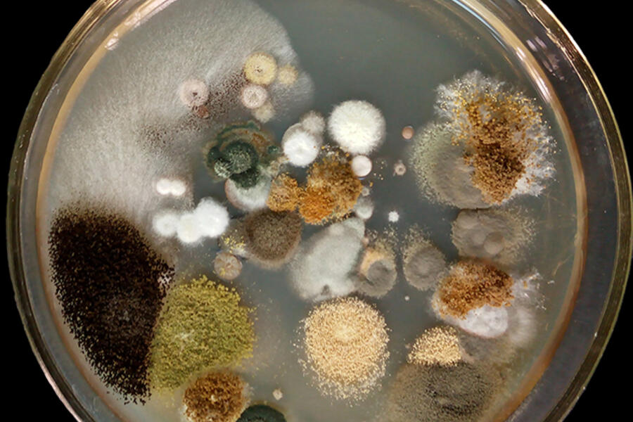 microbes in a petri dish