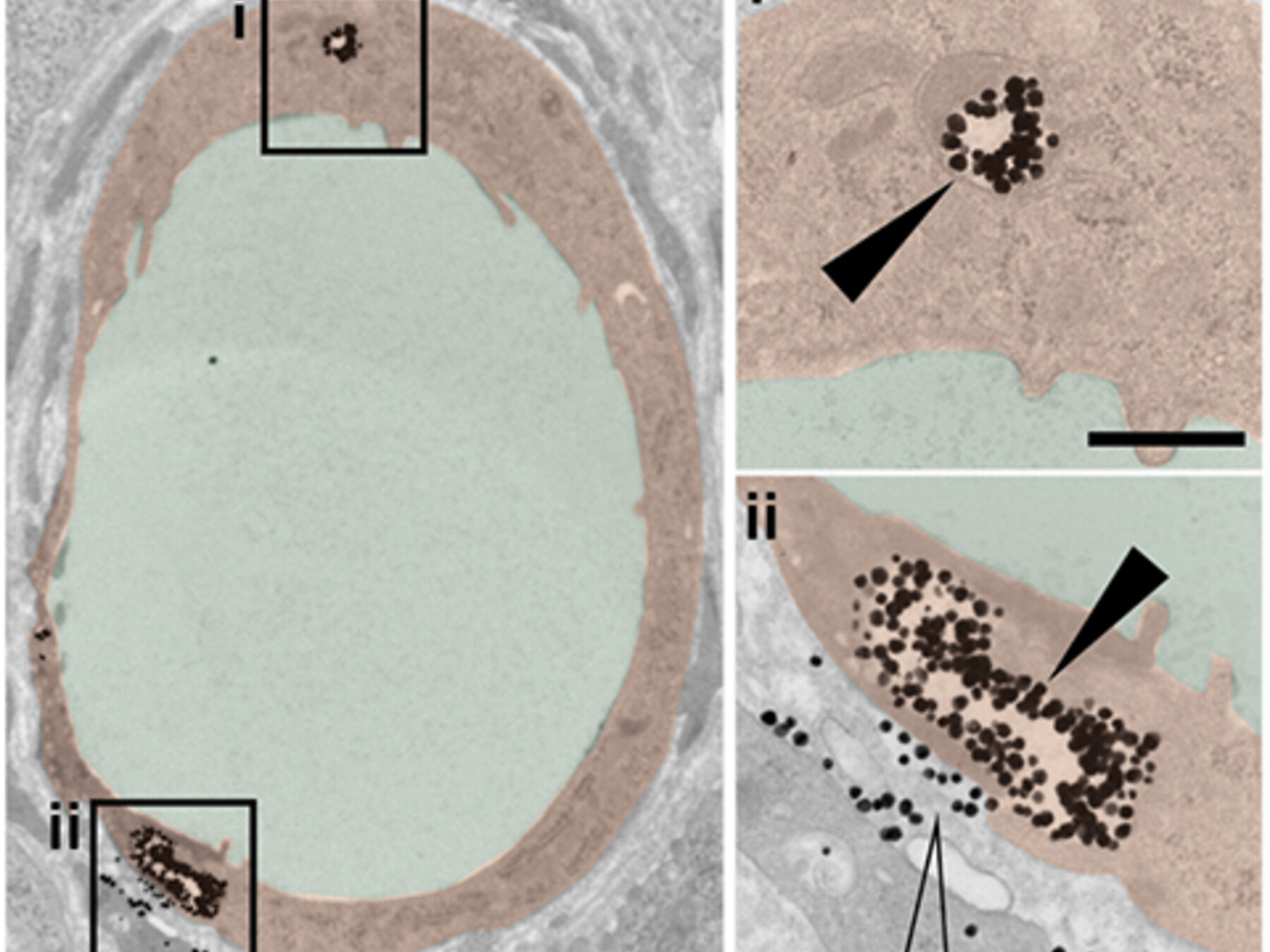 nanoparticles