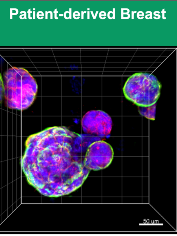 microscopy image of lab grown breast tissue