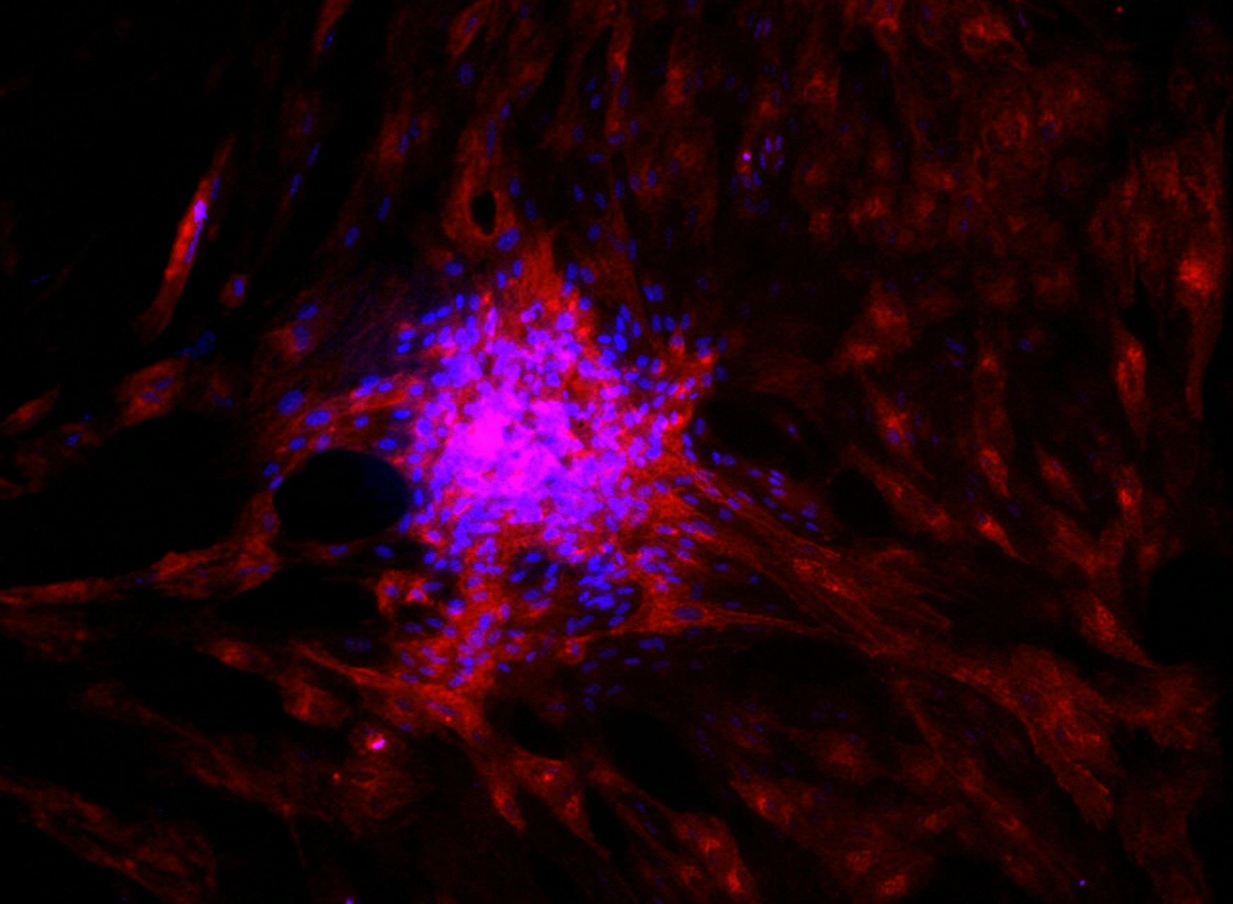 stem cells turning into photoreceptors in a dish