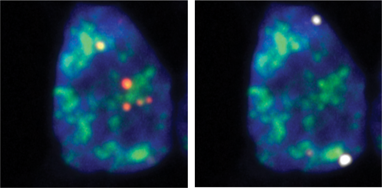 Microscopy images of cell nuclei with fluorescently labeled RNA transcripts 