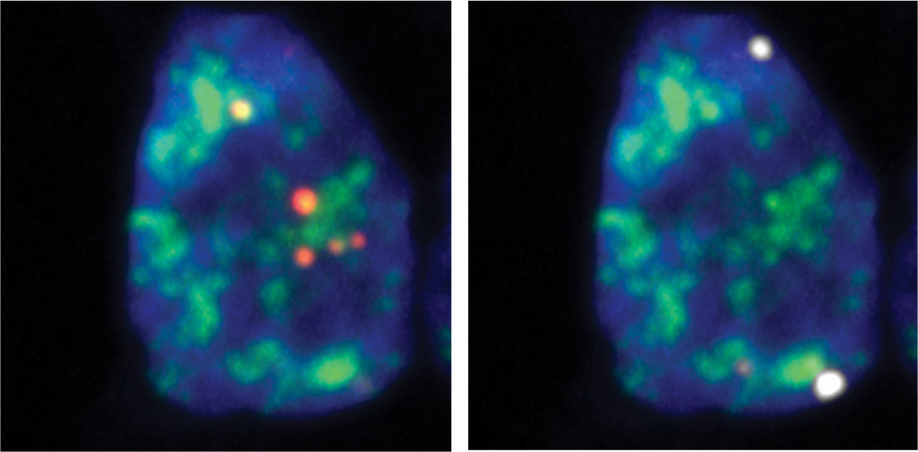 Microscopy images of cell nuclei with fluorescently labeled RNA transcripts