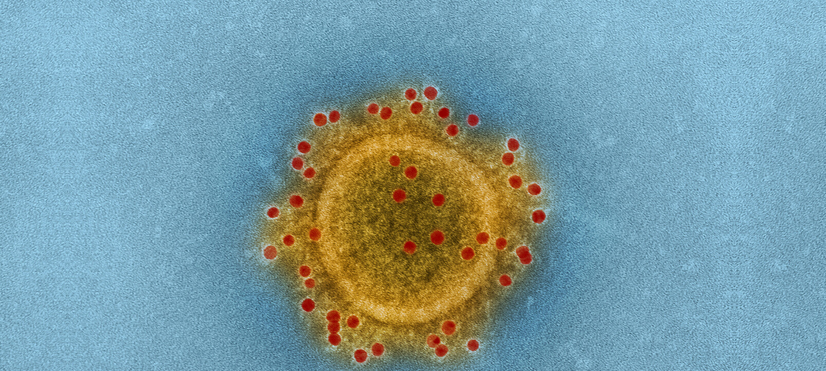 coronavirus