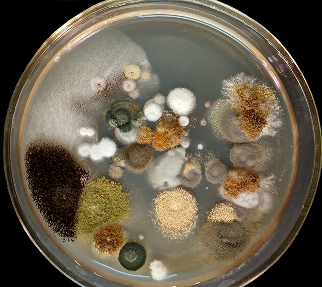 microbes in a petri dish